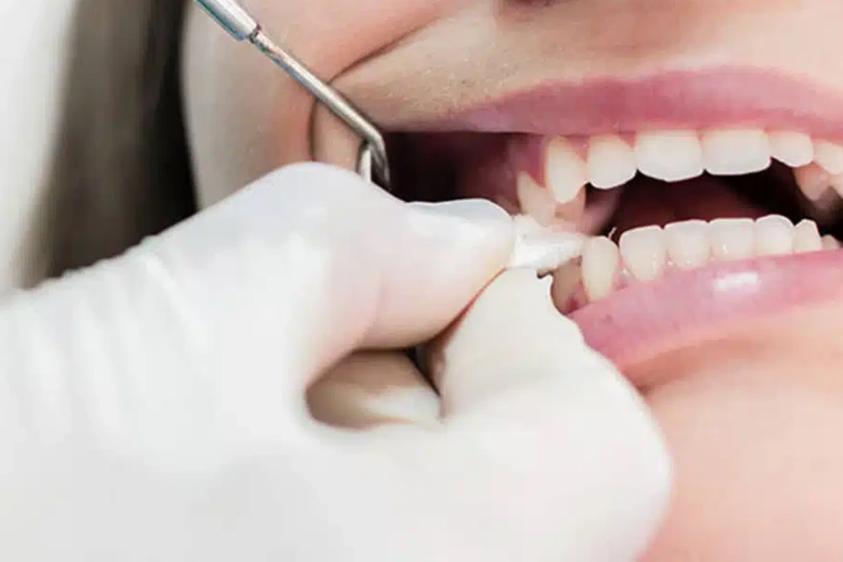 What Happens If You Don’t Extract a Bad Tooth?